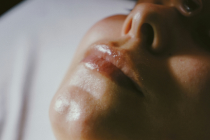 Derma-Plane Treatment